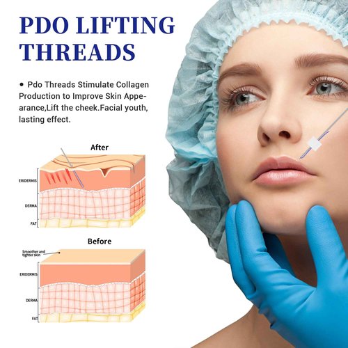 SOZOOM PDO Mono Thread, Pdo Threads Stimulate Collagen Production to Improve Skin Appearance (100PSC-29G-25mm)