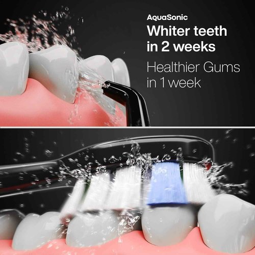 AquaSonic Home Dental Center PRO – Brushing & Flossing Made Easy – Brush & Floss – Power Toothbrush & Water Flosser – Whiter Teeth & Healthier Gums – Black Series Pro+Oral Irrigator