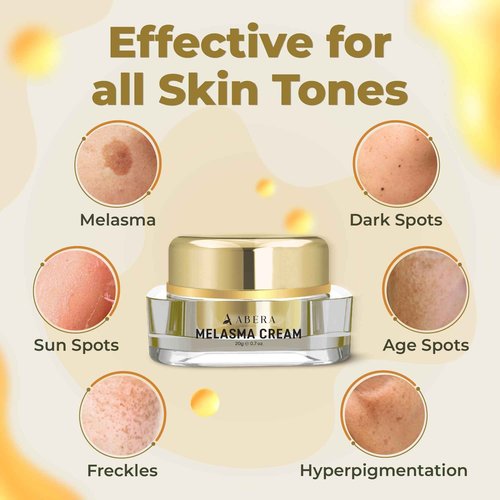 ABERA Melasma Cream (Premium Version) - Dark Spot Corrector, Melasma, Freckle, Sun Spot, Age Spot Remover Advanced Formula for Women and Men (set 2)