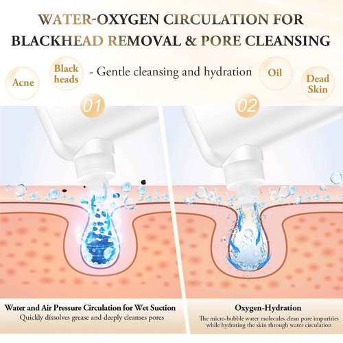 ANLAN Blackhead Remover for Face – Pore Extractor Vacuum with Microbubble Cleaning Blackhead Extractor Tools with 3 Suction Levels Acne Pimple Extractor Kit for Nose Face & T-Zone