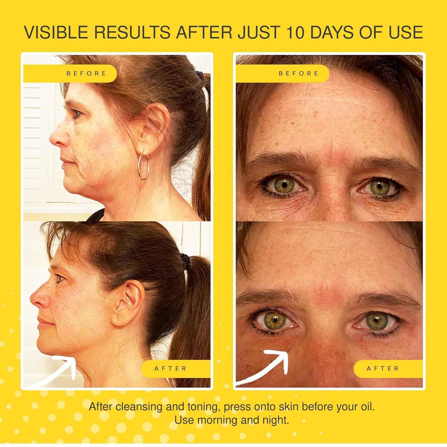 Jojoba Ultimate Serum - Anti-Aging - Reduces Appearance of Wrinkles, Crow?s Feet, Frown Lines & Fine Lines - Visibly Increases Skin Firmness - Hydrates & Tightens - 30ml