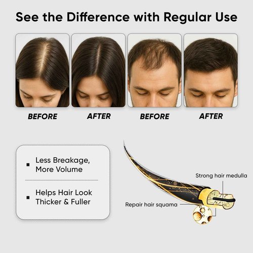 Thicair Hair Regrowth System - Volumizing Treatment with Copper Peptides & Collagen | Knotweed + Ginseng Root Extract | Supports Fuller, Healthier Looking Hair for Men & Women