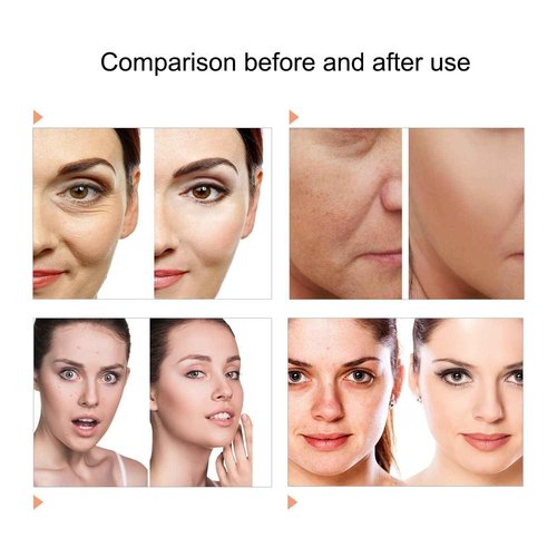 Caweiya 7 Color LED Face Mask LED Light Therapy Equipment for Skin Care at Home Beauty Salon Equipment