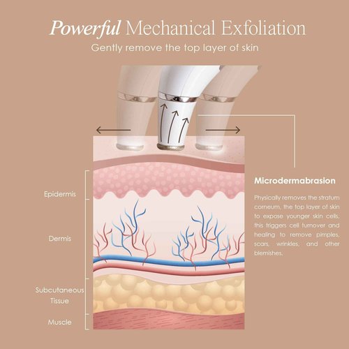 Reinvo Facial Microdermabrasion Wand by Project E Beauty | Gentle Exfoliation | Reduce Wrinkles & Fine Lines | Decrease Pores | Fresh & Radiant Skin | 4 Interchangeable Heads | Vacuum Suction Device