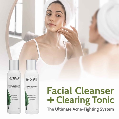 Exposed Skin Care, Basic Acne Treatment Kit with 2.5% Salicylic Acid and 3.5% Benzoyl Peroxide to Clear Up Teen, Adult, Hormonal and Cystic Acne – Natural, Non-toxic and Cruelty Free