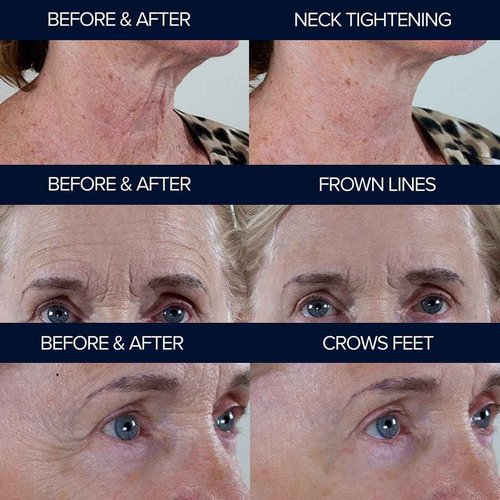 Adonia Organics Peptide10 – Anti-Aging Peptide Serum – Firms, Smooths & Reduces Wrinkles – With Multi-Peptide Complex for Youthful Skin