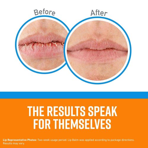 O'Keeffe's Cooling Relief Lip Repair Lip Balm for Dry, Cracked Lips, Stick, (Pack of 8)