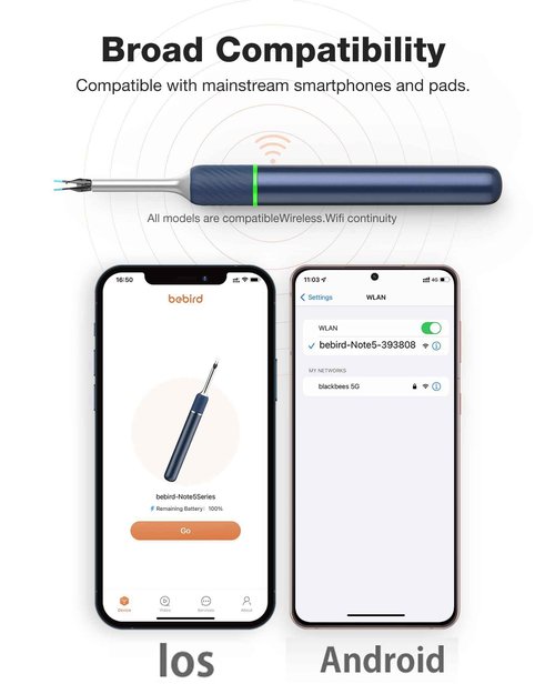 Highdas Ear Wax Removal Endoscope Otoscope, Earwax Remover Tools, Scope, with 1080P FHD Camera, 6 Led Lights, Wireless Connected, Compatible with iPhone, iPad, Android Smart Phones & Tablets