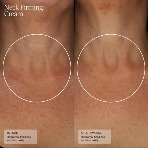 Senté Firming Neck Cream for Crepey Skin & Vertical Lines | Lifts, Firms & Smooths Neck & Décolleté | HSA, Caffeine, Vitamin C | 1.7 Fl Oz