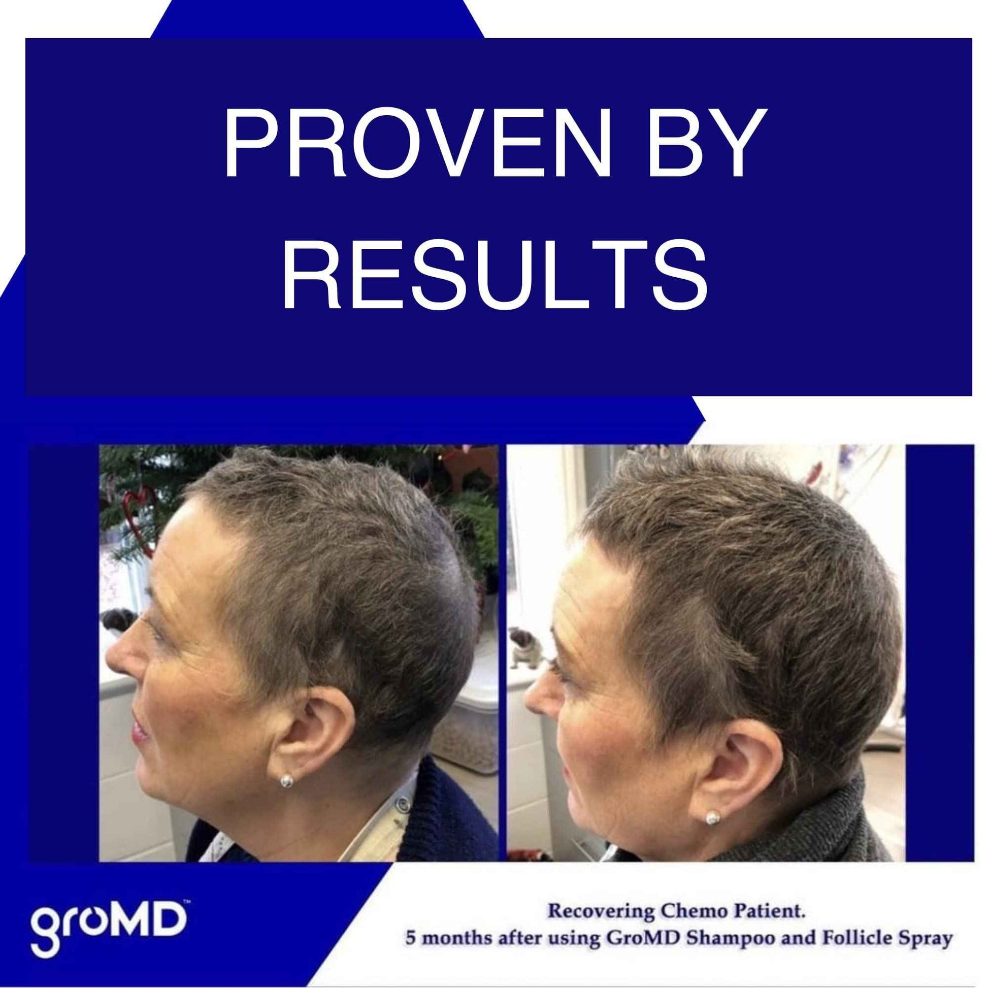 GroMD Hair Loss Serum, Hair Growth Treatment, Regrowth, Follicle Activator Spray, Argan Oil, Biotin & Caffeine, Thickening, Doctor Developed, DHT Blocking Ingredients, 60 Day Supply