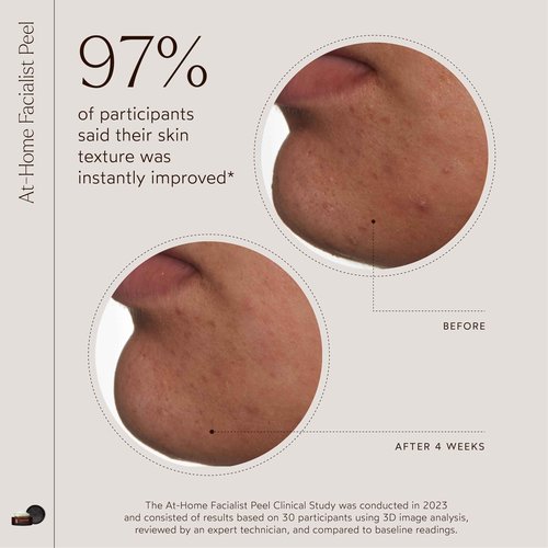 True Botanicals At-Home Facialist Peel Face Mask | Natural Exfoliating Treatment for Smooth, Radiant, Hydrated Skin | Dermatologist Tested, All Natural, Vegan, Clinically Proven | 1 fl oz | 30 ml