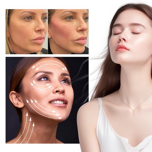 RYZESKI PDO Screw Thread, Lift Face Tip Screw Threads, PDO Threads Face Lifting Face & Whole Body (100PCS-29G*38mm)