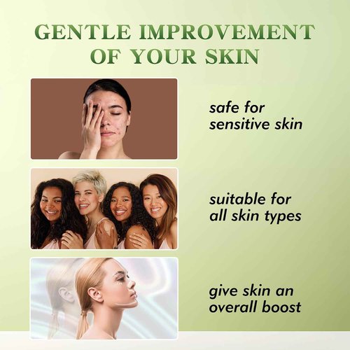 Elves Threads Lift for Face Whole Body Lifting/Screw Mono Threads for Eye lift/Protein Threads for Face/ 20pcs