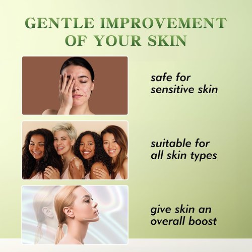 elves Pdo Threads for Face Lift/Whole body lifting Pdo Multi Threads L-Type Blunt 16pcs PDO Mono Threads 23G38mm Collagen Threads for Face Skin Tightening