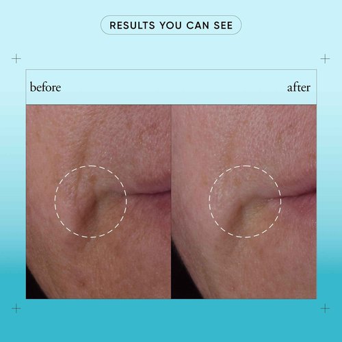 philosophy dose of wisdom bouncy skin revitalizing serum 1 fl oz