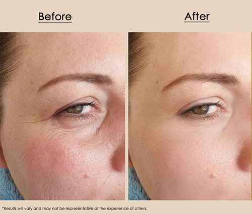 Redmint Ageless Facial Oil | Hydrating & Firming Face Oil with Squalane for Anti-Aging Glow | Inspired by TCM & Organic Botanicals for Radiant, Youthful Skin | 30ml