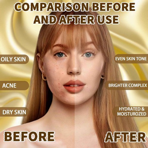 Ouhans Jelly Mask Set,Hyalorunic Acid Jelly Masks For Facials Professional,24k Hydro Jelly Mask, Jelly Face Mask, Facial Mask Mixing Bowl Set And Headband, Gift set for women'sDay, Skin care set