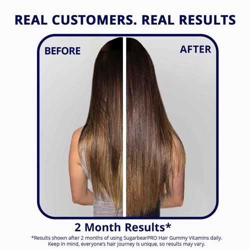 Sugarbear Gentle Detangling Bamboo Hair Brush + Vegan Hair Vitamin Gummies 3 Month Supply, Extra Strength Biotin 6000mcg for Supporting Healthy Straight, Wavy, Curly & Kinky Hair