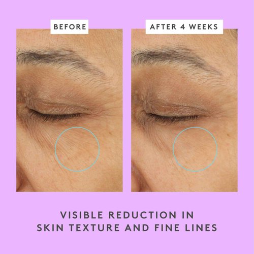 Drunk Elephant Ceramighty AF Eye Balm - 15 ml/.5 fl oz - Moisturizing Eye Cream - Clean Clinical Skincare - Cruelty-Free - Dermatologist-Tested - Free of Essential Oils, Silicones, and Fragrance