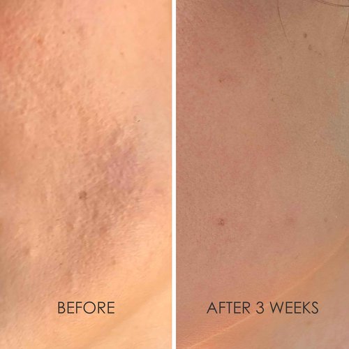 REFLEKT 3 Power Peptide Sculpting Face Cream