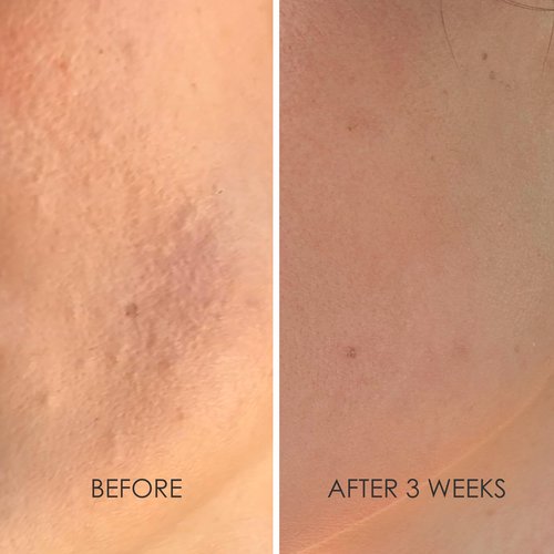 REFLEKT 2 Collagen Boost Vitamin C Serum