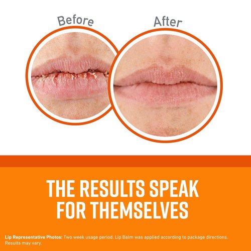 O'Keeffe's Unscented Lip Repair Lip Balm for Dry, Cracked Lips, Stick, (Pack of 12)