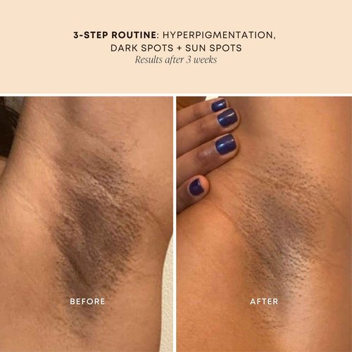 Bushbalm Dark Spots and Ingrown Hair 3 Step Routine - Rejuvenate and Nourish - Bermuda Oil (30 ml), Bermuda Dark Spot Exfoliating Scrub (236 ml) and Nordic Dry Brush