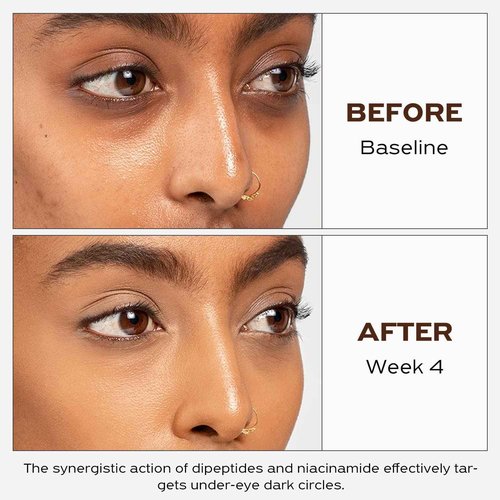 GoMay Lightweight Vitamin C Serum, Antioxidant Anti-aging Skincare, Smooth and Brighten Skin, Defy Age and Energize Skin