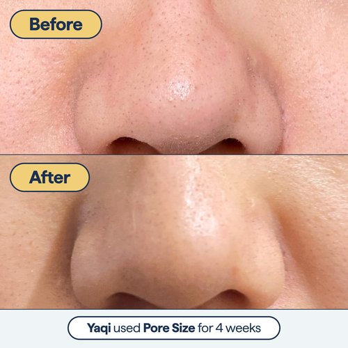 Dr. Shah's Dermatologist Bundle: 2x Remedy for Pore Size with Retinol, BHA Salicylic Acid & Niacinamide for Large Pores + 1x Remedy for Dry Lips with Ceramides, Peptides & Dimethicone for Cracked Lips