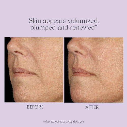 EXUVIANCE AGE REVERSE+ Advanced Total Correct Firming Antiaging Face Serum - For Fine Lines and Deep Wrinkles - Hydrates, Brightens & Evens Skin Tone with Peptides, Hyaluronic Acid and PHA, 1 Fl Oz