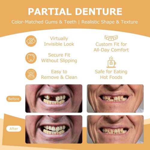 Partial Dentures - Dentures for Missing Teeth & Gaps - Lightweight & Unbreakable Replacement Teeth for Men & Women (1 Tooth)