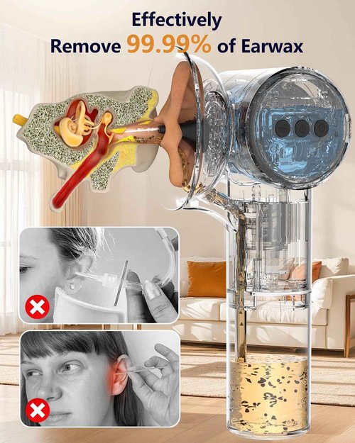 Upgraded Ear Wax Removal with Dual Tank, Wash & Dry 2-in-1, 160ml*2 Large Capacity Tank & 5 Pressure Modes, Ecleen Ear Cleaner Kit with USB-C Cable for Ear Cleaning & Ear Drying
