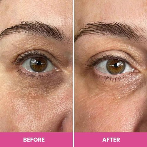 PRIME PROMETICS PrimeEyes Hydrate Under Eye Cream for Mature Women – Hydrating Eye Cream for Dark Circles and Wrinkle Repair – Soft, Glowing & Healthy Under Eyes