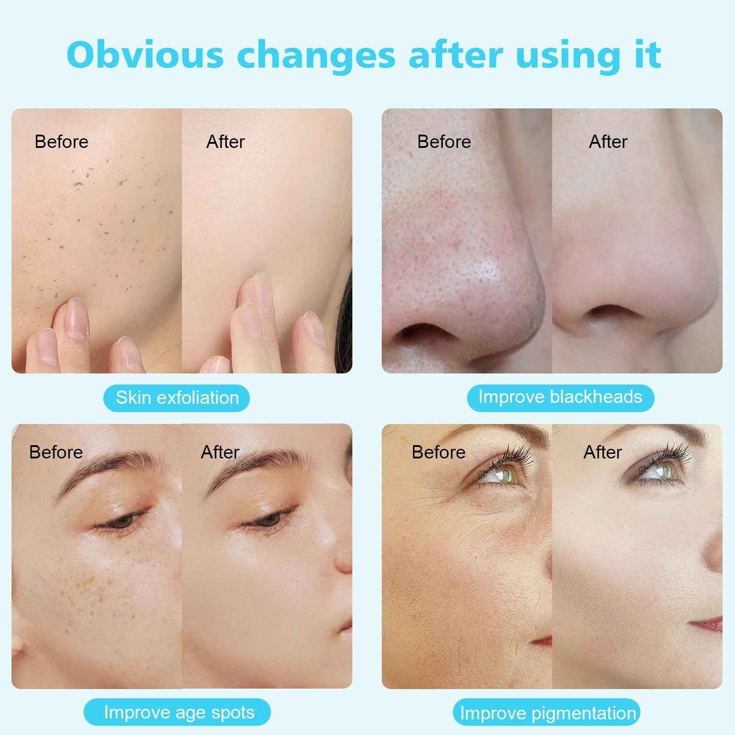 3 in 1 Diamond Micro DermaBrasion Machine, Mcwdoit Professional Dermabrasion Facial Skin Care Device with Wand, Spray Bottle and Vacuum Glass Tube for Personal Home Beauty Salon Use