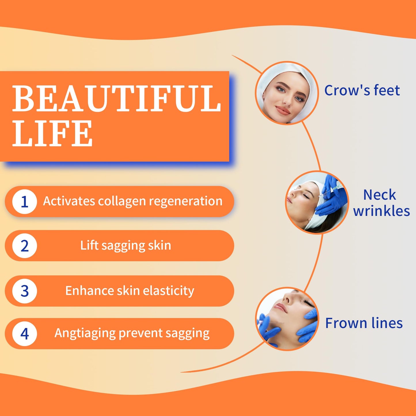 HYPOD PDO Screw Threads, PDO Thread Lift Korea Face/Whole Body PDO Thread Lifting and Filling (100PCS-S30G-38mm)