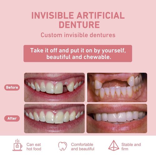 Custom Partial Dentures – Personalized Removable Denture Set for Missing Teeth | 1–6 Tooth Replacement with Storage Case | Natural Look & Comfortable Fit (1 Tooth)