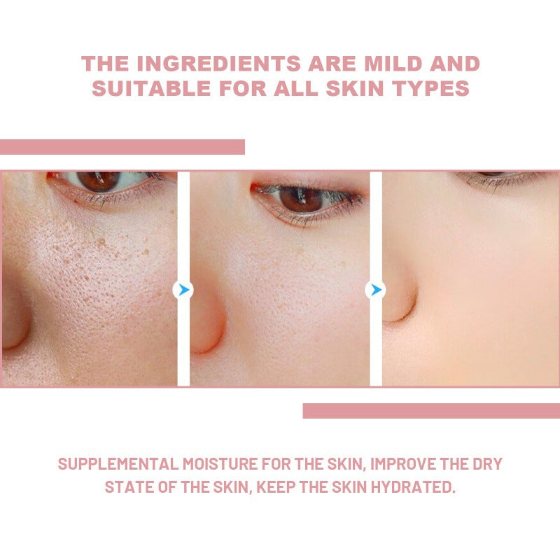 Nicotinamide Hydrating Skin Care Solution for Moisturizing - 30ml