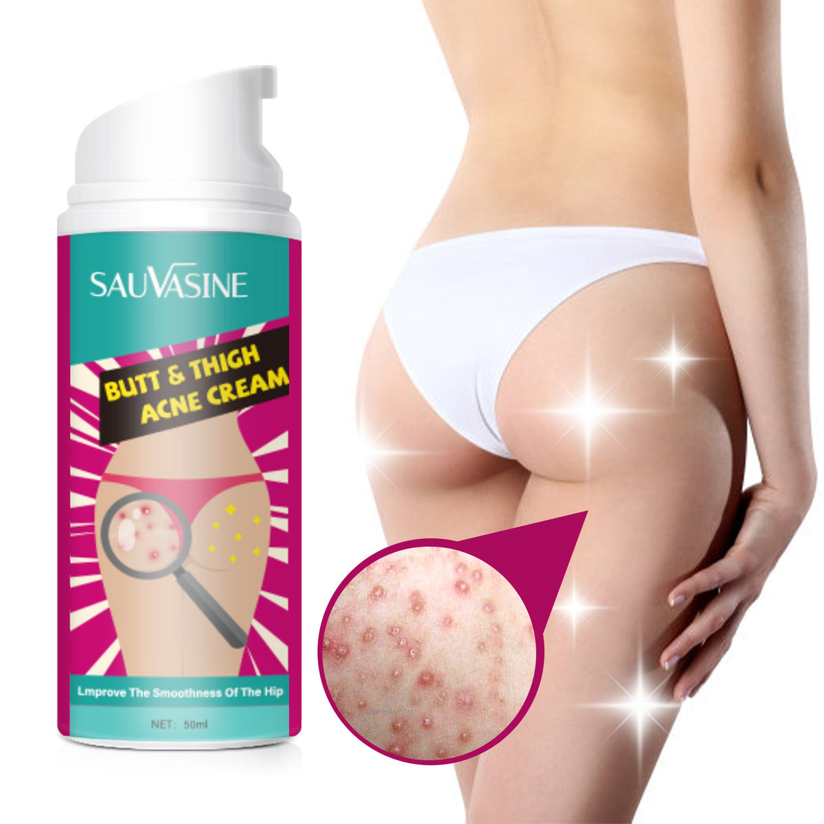 Hip and Leg Acne Moisturizing Cream - 50ml Body Care for Skin Relief