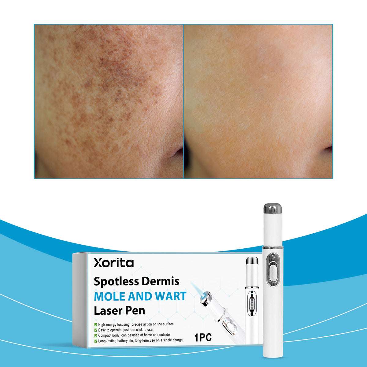 Skin Care Laser Pen