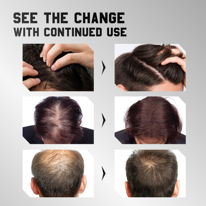 Anti-Breakage Hair Nourishing Essence for Dry and Frizzy Hair