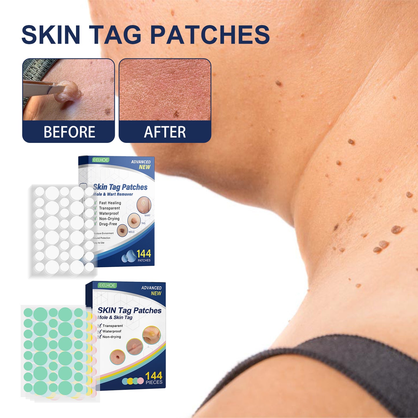 Skin Smoothing Patches 144PCS for Skin Tag & Mole Removal - 36PCS x 4 Sheets