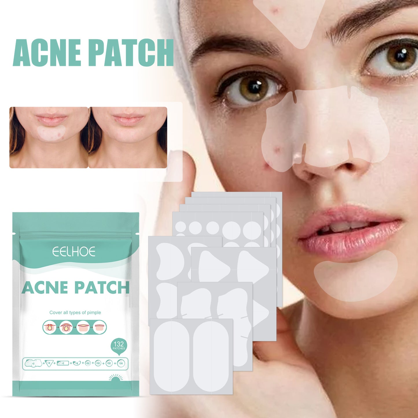 Tea Tree & Calendula Acne Healing Patch - Gentle Blemish Treatment