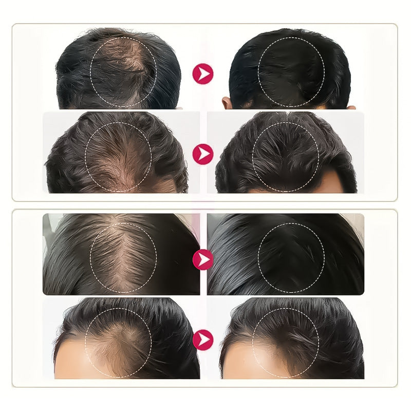Collagen Hair Growth Oil Treatment - 30ml