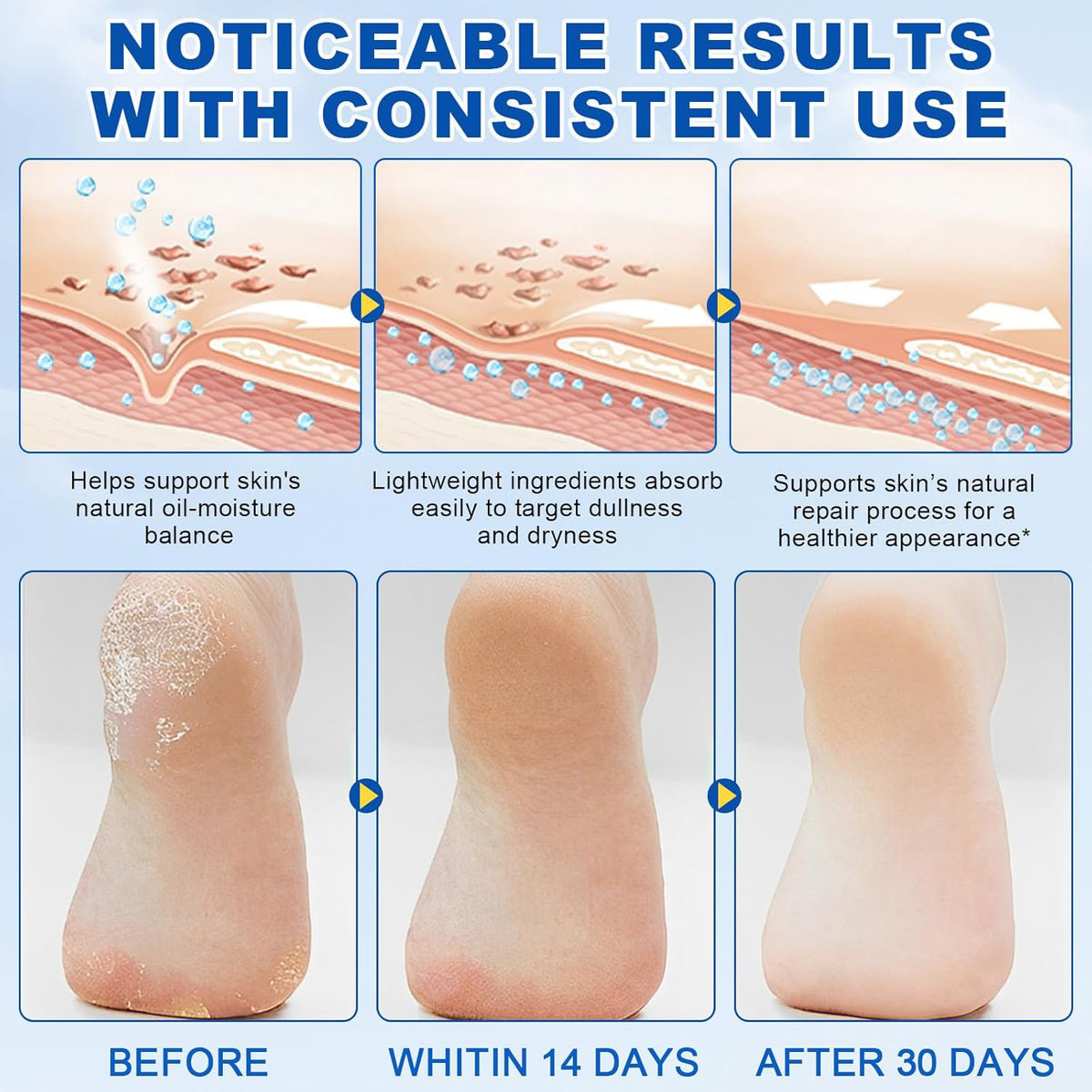 Urea Body Lotion - Hydrating Moisturizer for Dry Skin