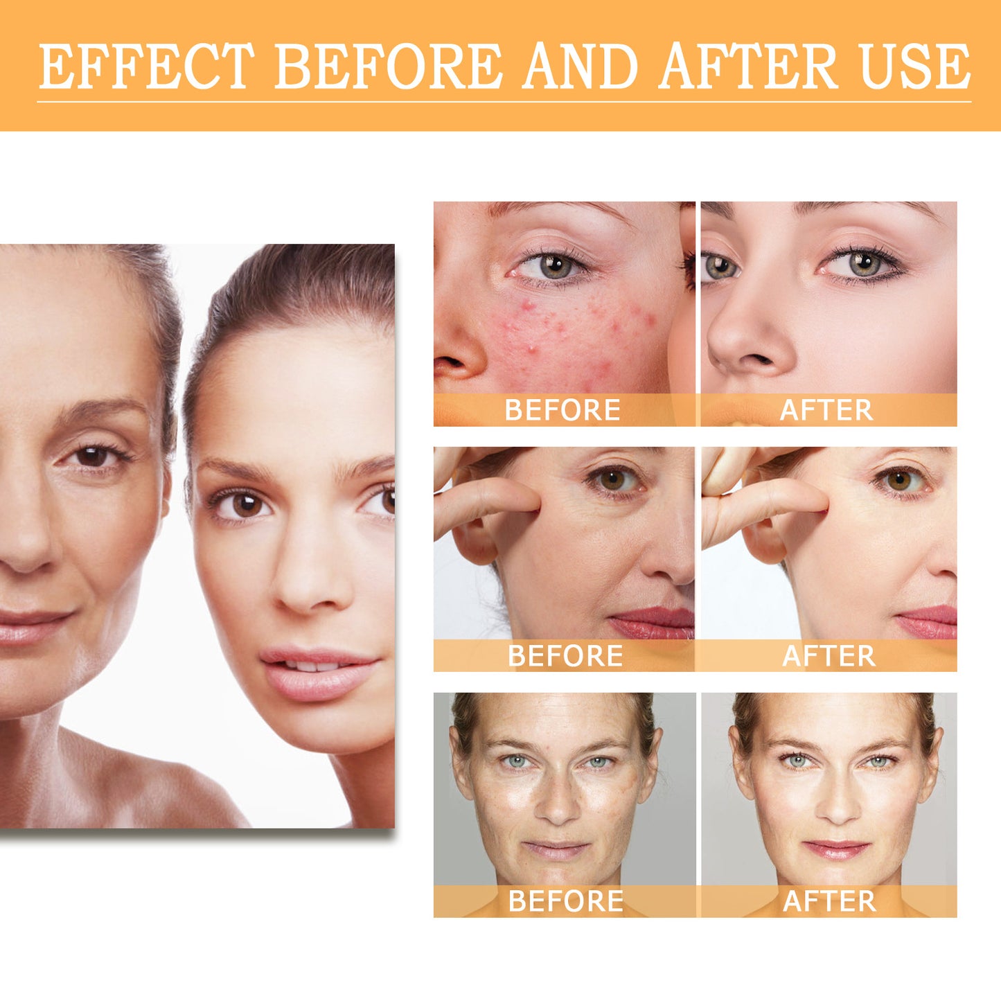 Glycolic Acid 7% Facial Lotion for Acne, 100ml - Moisturizing & Exfoliating