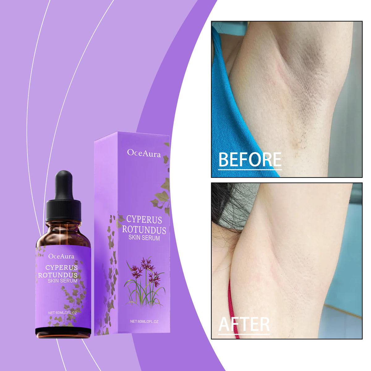Post Hair Removal Repair Essence - 60ml Soothing Skin Care Serum