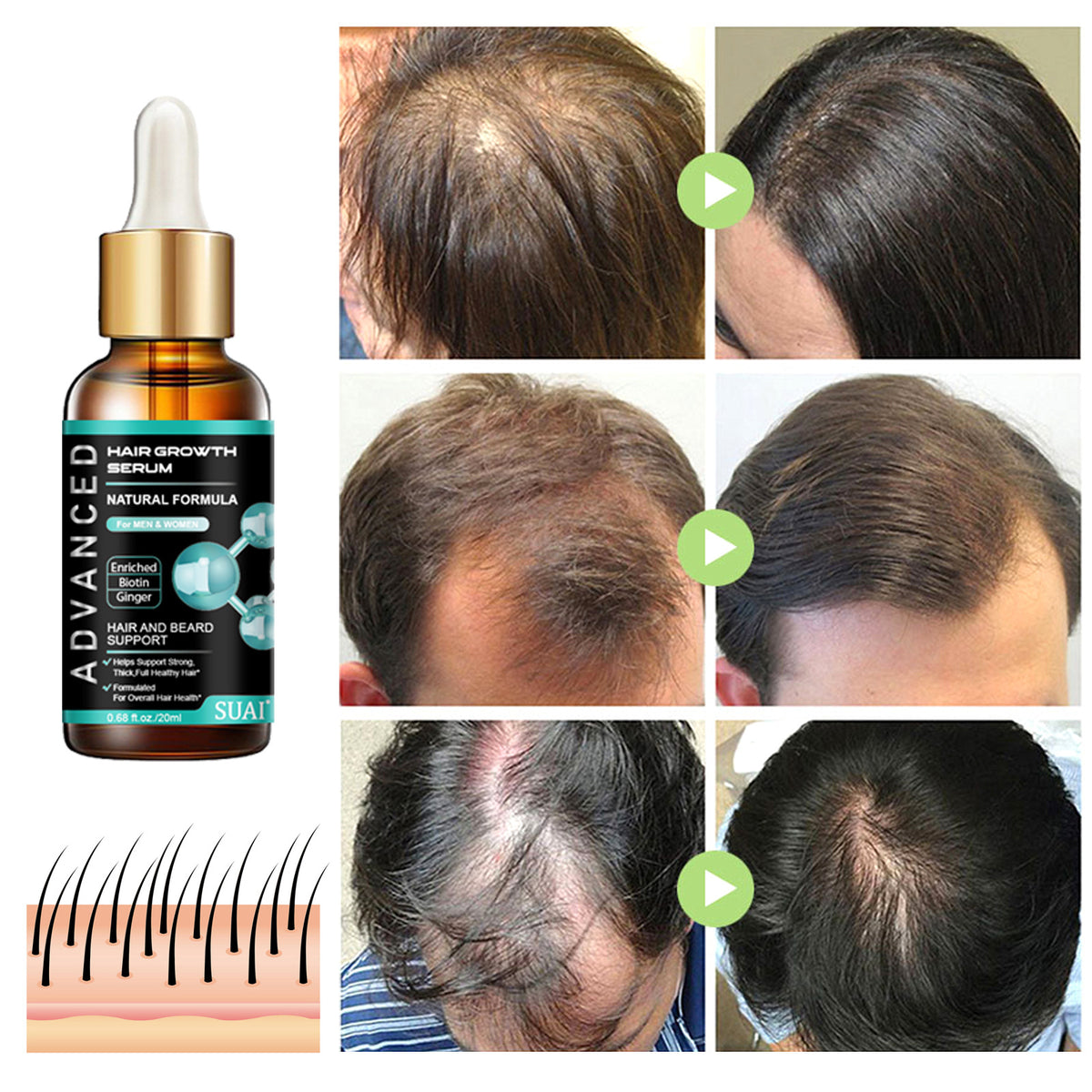 Ginger Hair Nutrient Oil – 20ml