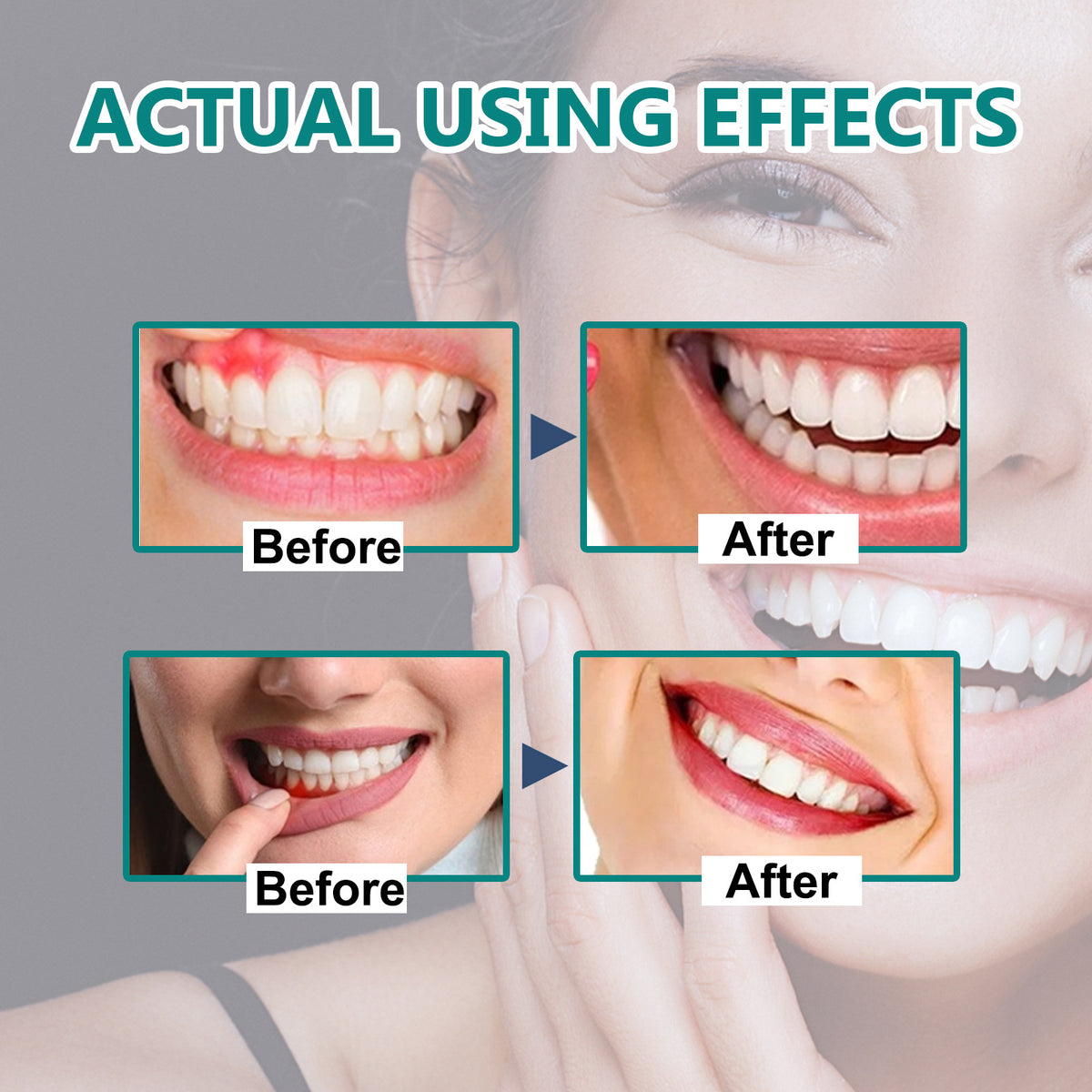 Repair Swelling And Aching Of Gum Cleaning Tooth Stains Oral Care