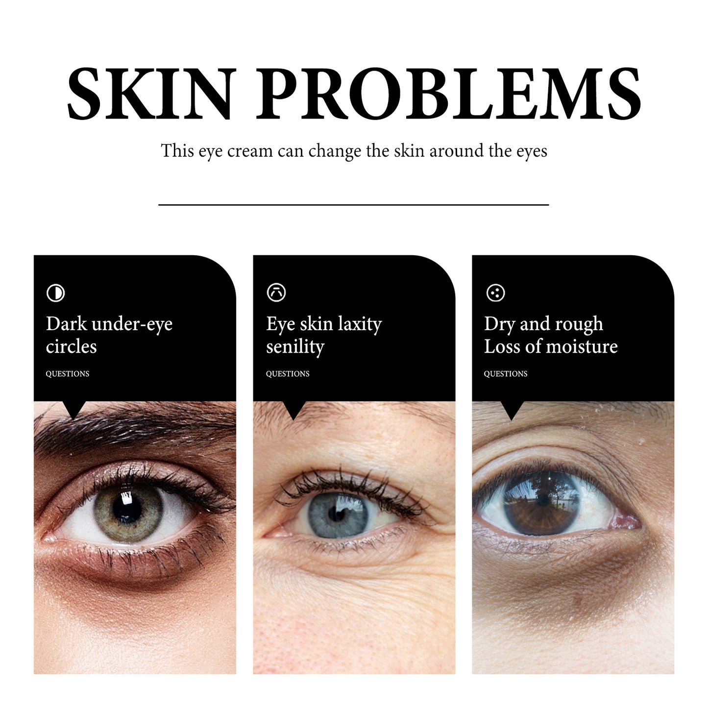 Hydrating Eye Cream for Dark Circles and Puffiness - Niacinamide Formula