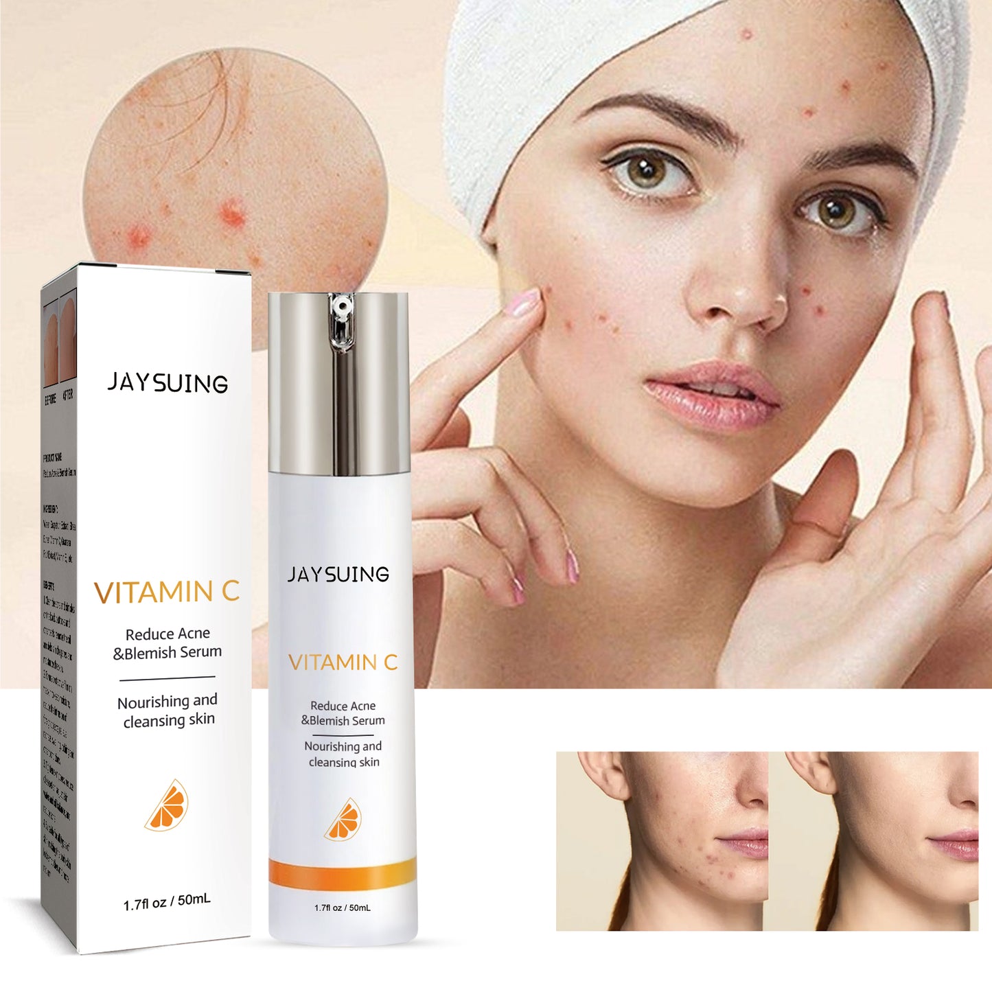 Anti-Acne Body Serum with Collagen Peptide - 50ml Pore Refining Treatment